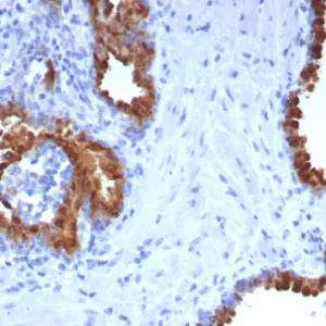 Formalin-fixed, paraffin-embedded human prostate stained with PTPRU Mouse Monoclonal Antibody (PTPRU/7616). HIER: Tris/EDTA, pH9.0, 45min. 2°C: HRP-polymer, 30min. DAB, 5min.