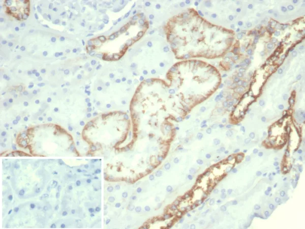 Recombinant Ksp-Cadherin (Kidney-Specific Cadherin) / CDH16 Antibody