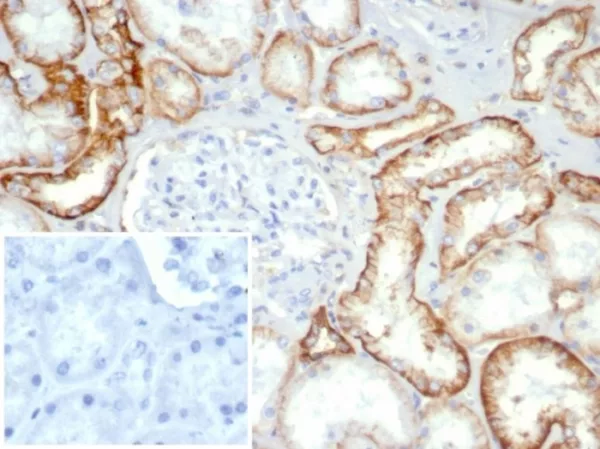 Recombinant Ksp-Cadherin (Kidney-Specific Cadherin) / CDH16 Antibody