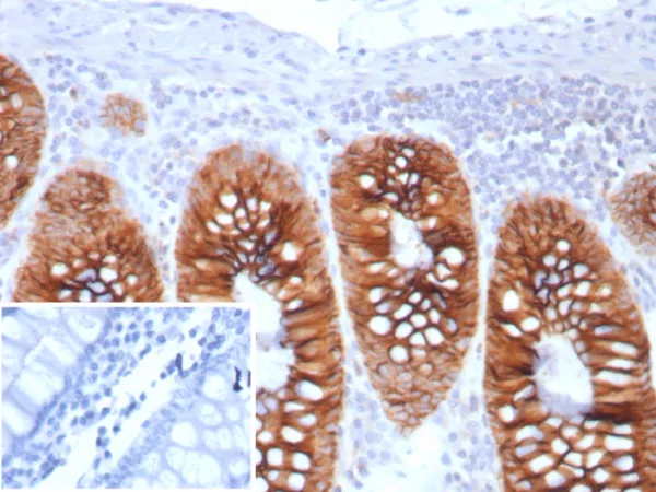 Formalin-fixed, paraffin-embedded human colon stained with CDH17 Recombinant Rabbit Monoclonal Antibody (CDH17/8513R). Inset: PBS instead of primary antibody; secondary only negative control.