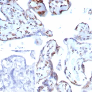 IHC analysis of formalin-fixed, paraffin-embedded human placenta.  Strong nuclear staining using KIP2/7639 at 2ug/ml in PBS for 30min RT. Inset: PBS instead of primary antibody; secondary only negative control.