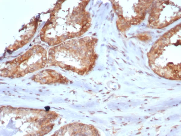 CARM1 Antibody in Immunohistochemistry (IHC (P))