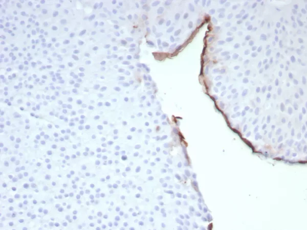 Formalin-fixed, paraffin-embedded human bladder stained with Uroplakin 3B Recombinant Rabbit Monoclonal Antibody (UPK3B/8768R). HIER: Tris/EDTA, pH9.0, 45min. 2°C: HRP-polymer, 30min. DAB, 5min.