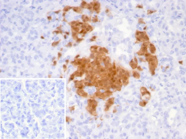 Formalin-fixed, paraffin-embedded human pancreas stained with Secretagogin (SCGN) Mouse Monoclonal Antibody (SCGN/7321). Inset: PBS instead of primary antibody; secondary only negative control.