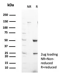 SDS-PAGE Analysis of Purified Secretagogin (SCGN) Mouse Monoclonal Antibody (SCGN/7326). Confirmation of Purity and Integrity of Antibody.