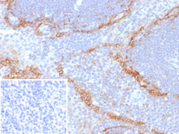 Formalin-fixed, paraffin-embedded human tonsil stained with Podoplanin Recombinant Mouse Monoclonal Antibody (rPDPN/6994). Inset: PBS instead of primary antibody; secondary only negative control.