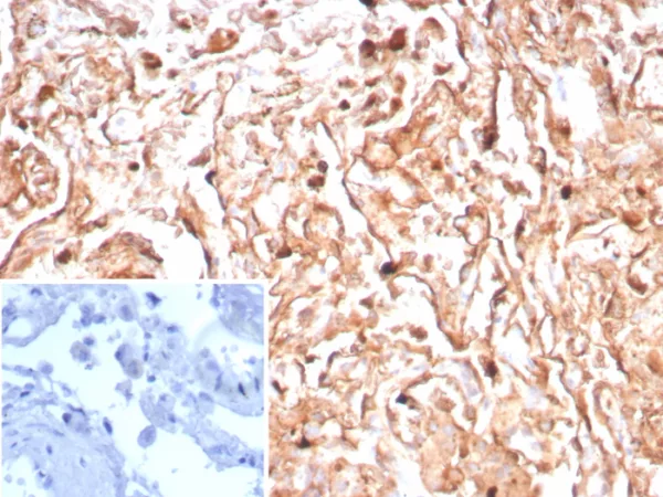 Recombinant Podoplanin (PDPN) (Lymphatic Endothelial & Mesothelial Marker) Antibody