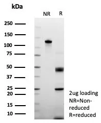 SDS-PAGE Analysis of Purified Periostin Recombinant Mouse Monoclonal Antibody (rPOSTN/8522). Confirmation of Purity and Integrity of Antibody.