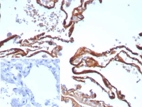 Recombinant Periostin (POSTN) Antibody - Image 2