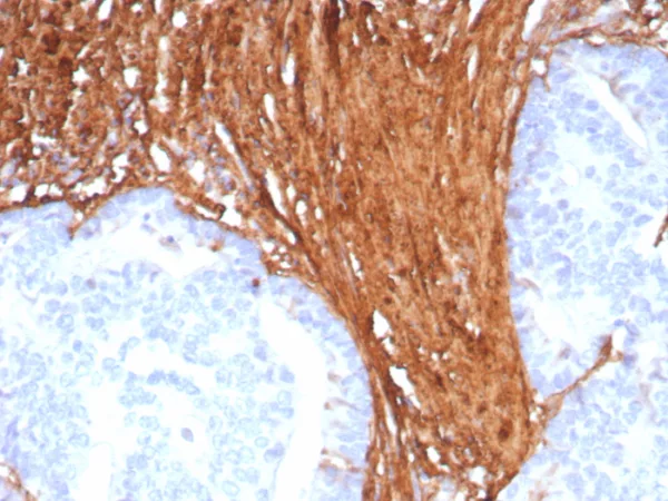 Recombinant Periostin (POSTN) Antibody - Image 3