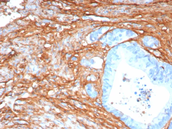 Formalin-fixed, paraffin-embedded human colon stained with Periostin Recombinant Rabbit Monoclonal Antibody (POSTN/8165R). HIER: Tris/EDTA, pH9.0, 45min. 2°C: HRP-polymer, 30min. DAB, 5min.