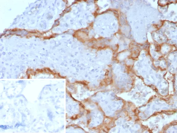 Formalin-fixed, paraffin-embedded human placenta stained with HCG-beta Mouse Monoclonal Antibody (hCGa/7872). Inset: PBS instead of primary antibody; secondary only negative control.