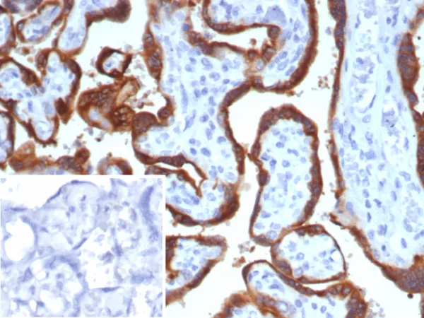 HCG-alpha Antibody in Immunohistochemistry (IHC (P))