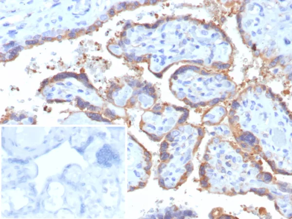 Formalin-fixed, paraffin-embedded human placenta stained with HCG-beta Recombinant Mouse Monoclonal Antibody (rHCGa/6975). Inset: PBS instead of primary antibody; secondary only negative control.