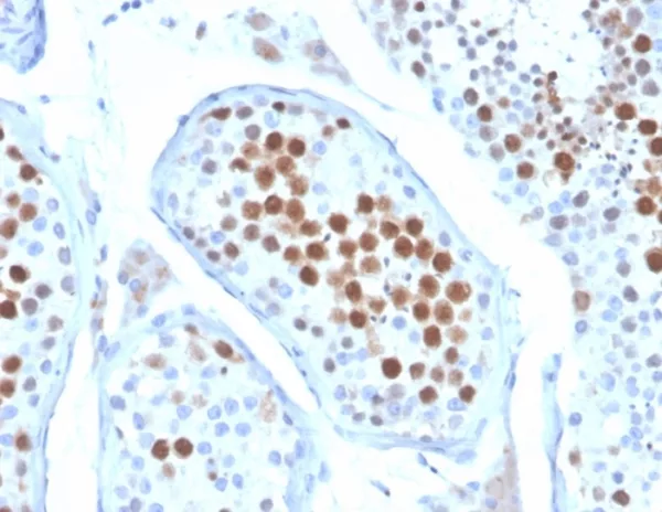 Formalin-fixed, paraffin-embedded human testis stained with KIF2C Mouse Monoclonal Antibody (KIF2C/6522) at 2ug/ml. HIER: Tris/EDTA, pH9.0, 45min. 2°C: HRP-polymer, 30min. DAB, 5min.