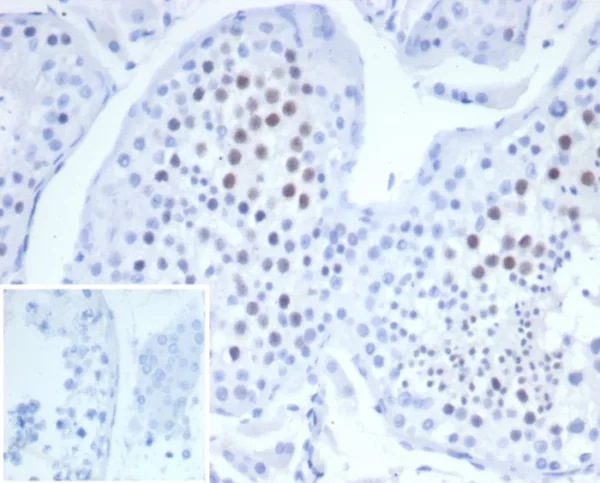 KIF2C (Kinesin Family Member 2C) / MCAK Antibody