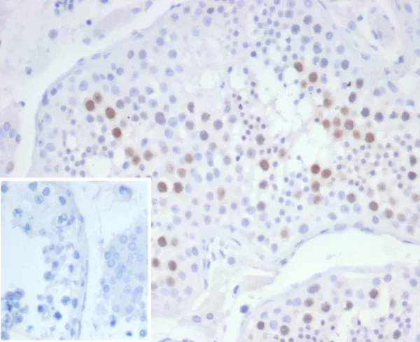 KIF2C (Kinesin Family Member 2C) / MCAK Antibody