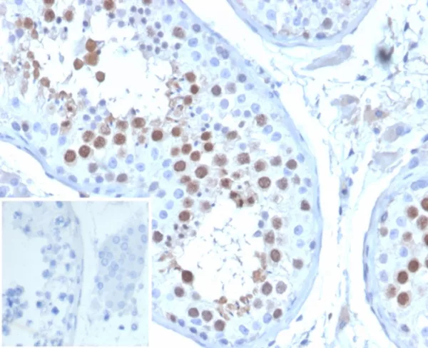 KIF2C (Kinesin Family Member 2C) / MCAK Antibody