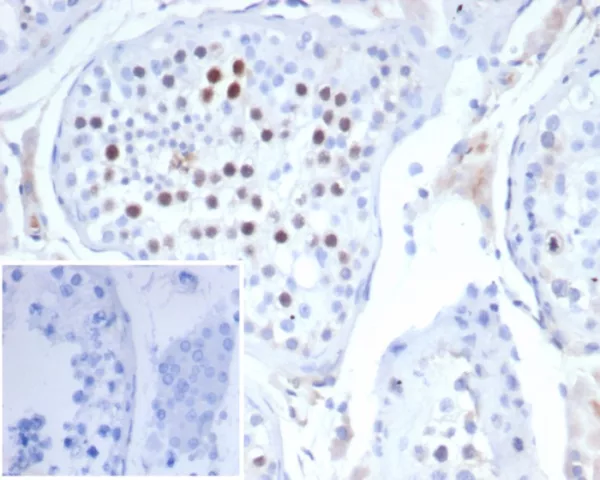 KIF2C (Kinesin Family Member 2C) / MCAK Antibody