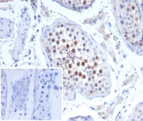 KIF2C (Kinesin Family Member 2C) / MCAK Antibody