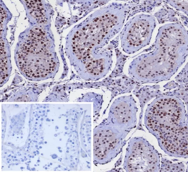 Formalin-fixed, paraffin-embedded human testis stained with KIF2C Mouse Monoclonal Antibody (KIF2C/4707) at 2ug/ml. Inset: PBS instead of primary antibody; secondary only negative control.
