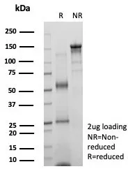 SDS-PAGE Analysis of Purified KIF2C Mouse Monoclonal Antibody (KIF2C/6519). Confirmation of Purity and Integrity of Antibody.