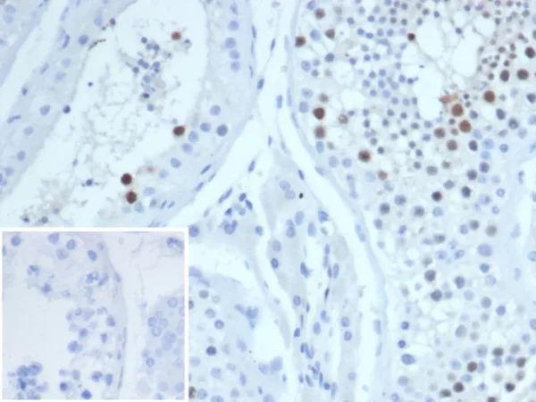 KIF2C (Kinesin Family Member 2C) / MCAK Antibody - Image 2