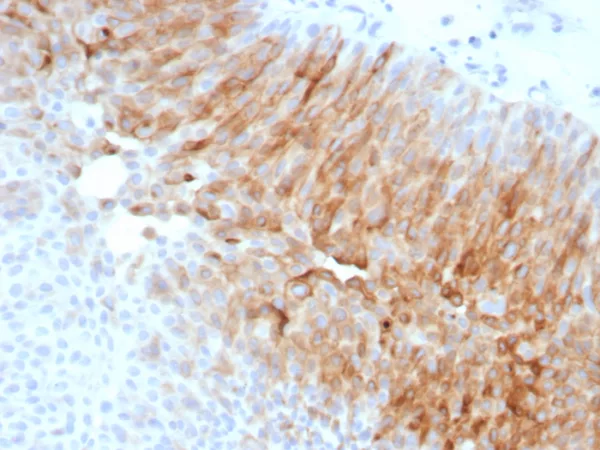 Recombinant Uroplakin 1A (Urothelial Differentiation Marker) Antibody - Image 2