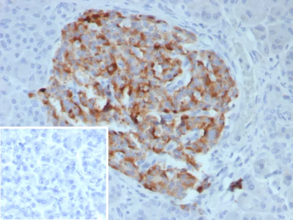 Chromogranin B Antibody in Immunohistochemistry (IHC (P))