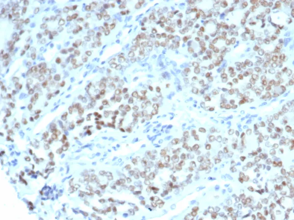 BTBD9 Antibody