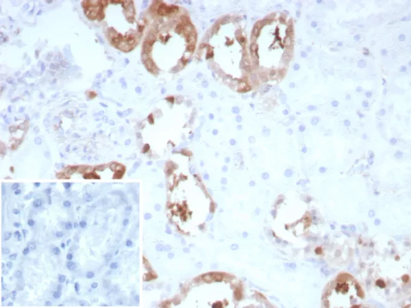 Formalin-fixed, paraffin-embedded human kidney stained with CKBB Recombinant Mouse Monoclonal Antibody (rCKBB/8839). Inset: PBS instead of primary antibody; secondary only negative control.