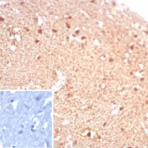 Formalin-fixed, paraffin-embedded human brain stained with CKBB Recombinant Mouse Monoclonal Antibody (rCKBB/8844). Inset: PBS instead of primary antibody; secondary only negative control.