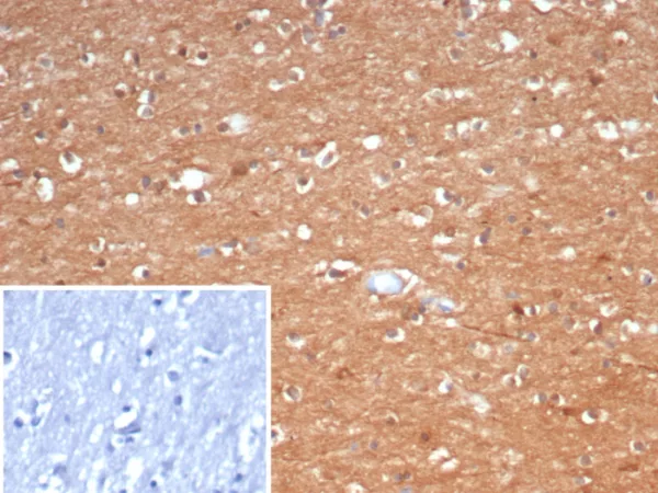 Formalin-fixed, paraffin-embedded human brain stained with CKBB Mouse Monoclonal Antibody (CKBB/6566). Inset: PBS instead of primary antibody; secondary only negative control.