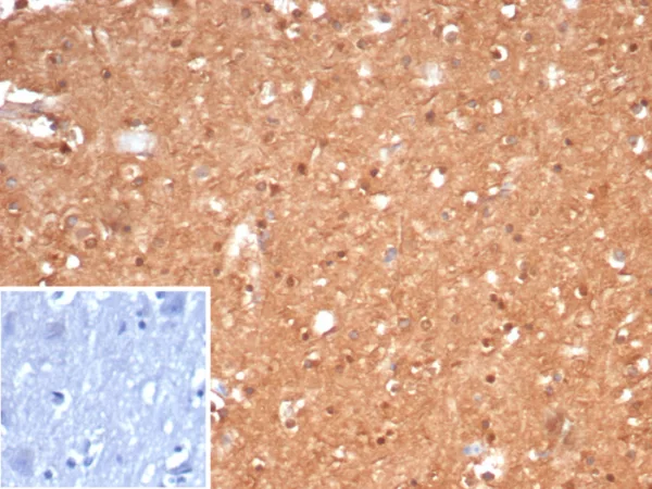 CKBB Antibody in Immunohistochemistry (IHC (P))