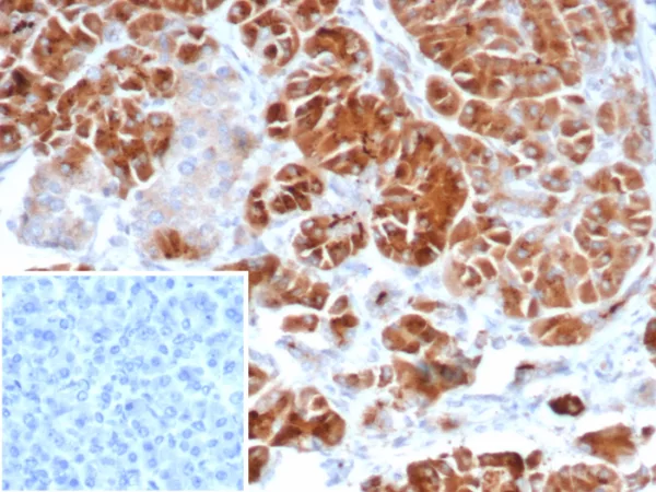 IL22RA2 Antibody - Image 2