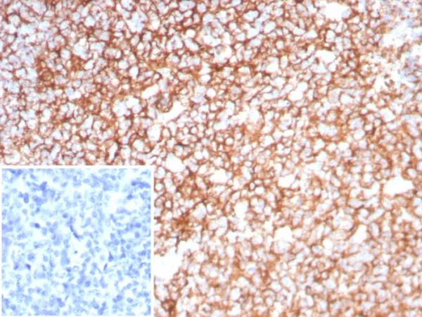 Recombinant Clusterin / Apolipoprotein J (APO-J) Antibody