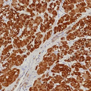 Formalin-fixed, paraffin-embedded human uterus stained with Calponin-1 Recombinant Mouse Monoclonal Antibody (rCNN1/9164). HIER: Tris/EDTA, pH9.0, 45min. 2°C: HRP-polymer, 30min. DAB, 5min.