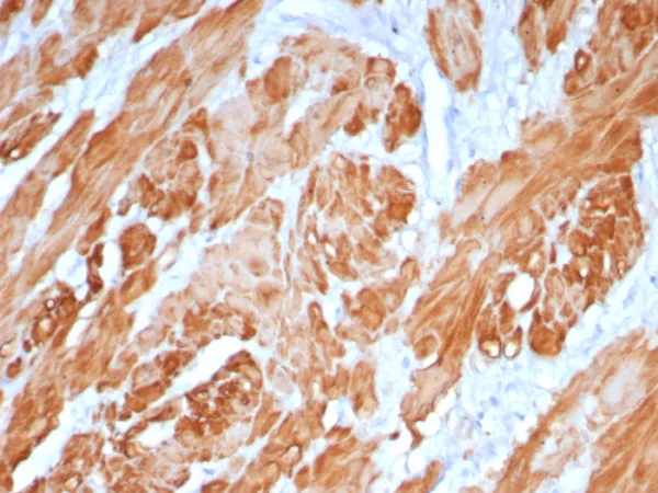 Formalin-fixed, paraffin-embedded human uterus stained with Calponin-1 Recombinant Mouse Monoclonal Antibody (rCNN1/6918). HIER: Tris/EDTA, pH9.0, 45min. 2°C: HRP-polymer, 30min. DAB, 5min.