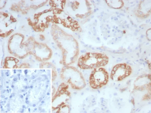 Recombinant Collagen II (COL2A1) Antibody