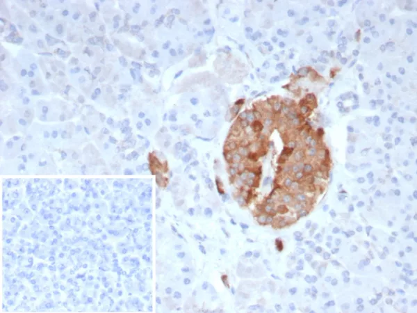 Formalin-fixed, paraffin-embedded human pancreas stained with Collagen IV Recombinant Rabbit Monoclonal Antibody (COL4/9395R). Inset: PBS instead of primary antibody; secondary only negative control.