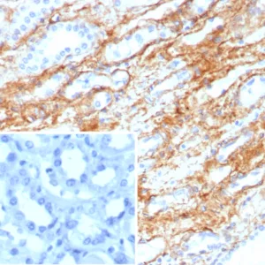 Formalin-fixed, paraffin-embedded human kidney stained with Collagen IV Recombinant Rabbit Monoclonal Antibody (COL4/8657R). Inset: PBS instead of primary antibody; secondary only negative control.