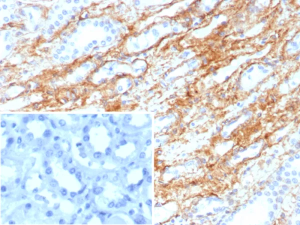 Formalin-fixed, paraffin-embedded human kidney stained with Collagen IV Recombinant Rabbit Monoclonal Antibody (COL4/8657R). Inset: PBS instead of primary antibody; secondary only negative control.