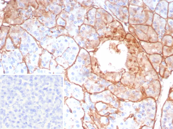 Formalin-fixed, paraffin-embedded human pancreas stained with COL4A5 Recombinant Rabbit Monoclonal Antibody (COL4A5/9396R). Inset: PBS instead of primary antibody; secondary only negative control.