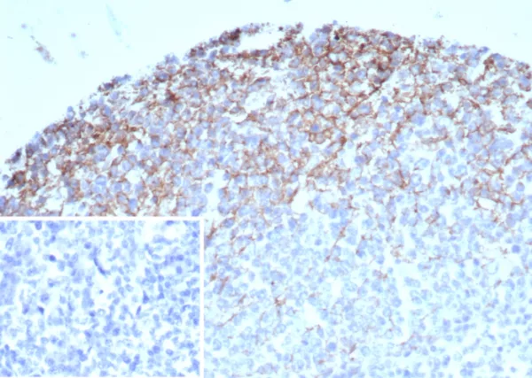 Formalin-fixed, paraffin-embedded human tonsil stained with CD35 Mouse Monoclonal Antibody (CR1/7108) at 2ug/ml. Inset: PBS instead of primary antibody; secondary only negative control.