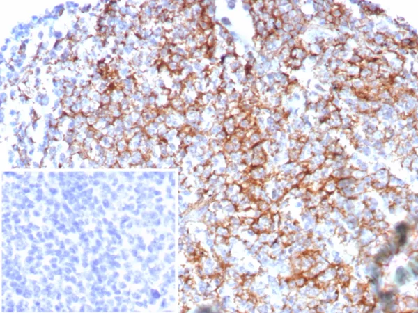 Formalin-fixed, paraffin-embedded human tonsil stained with CD35 Recombinant Mouse Monoclonal Antibody (rCR1/8596). Inset: PBS instead of primary antibody; secondary only negative control.