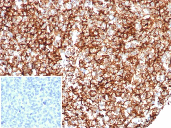 Recombinant CD35 / CR1 (Follicular Dendritic Cell Marker) Antibody - Image 2