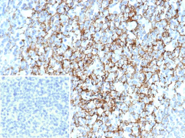 CD35 / CR1 (Follicular Dendritic Cell Marker) Antibody - Image 2