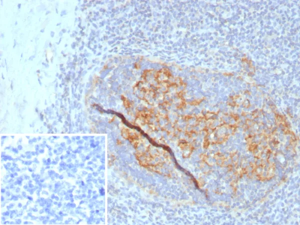 Formalin-fixed, paraffin-embedded human tonsil stained with CD35 Recombinant Rabbit Monoclonal Antibody (CR1/8223R). Inset: PBS instead of primary antibody; secondary only negative control.