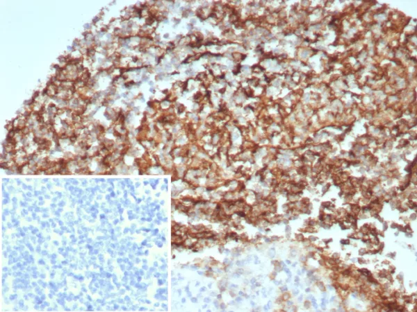 Formalin-fixed, paraffin-embedded human kidney stained with CD35 Recombinant Rabbit Monoclonal Antibody (CD35/8674R) at 2ug/ml. Inset: PBS instead of primary antibody; secondary only negative control.