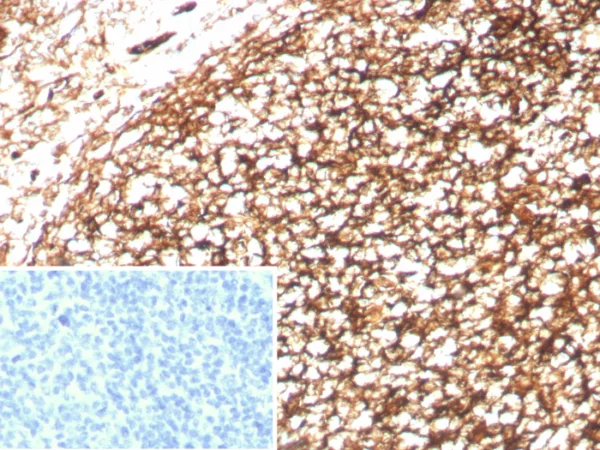 Formalin-fixed, paraffin-embedded human tonsil stained with CD35 Recombinant Rabbit Monoclonal Antibody (CD35/8833R). Inset: PBS instead of primary antibody; secondary only negative control.